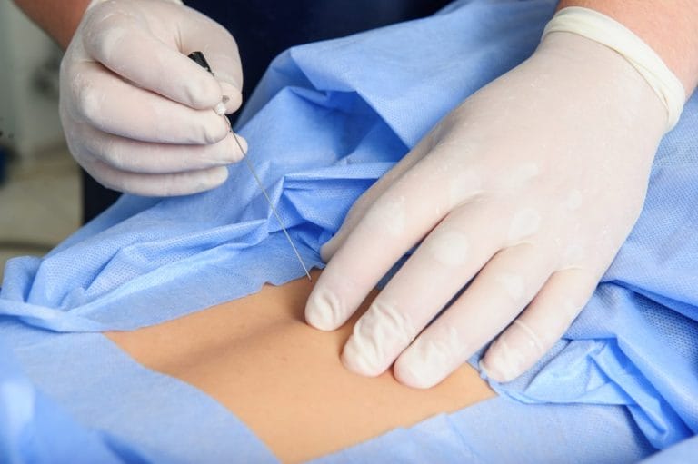 spinal injection 1200x798 1