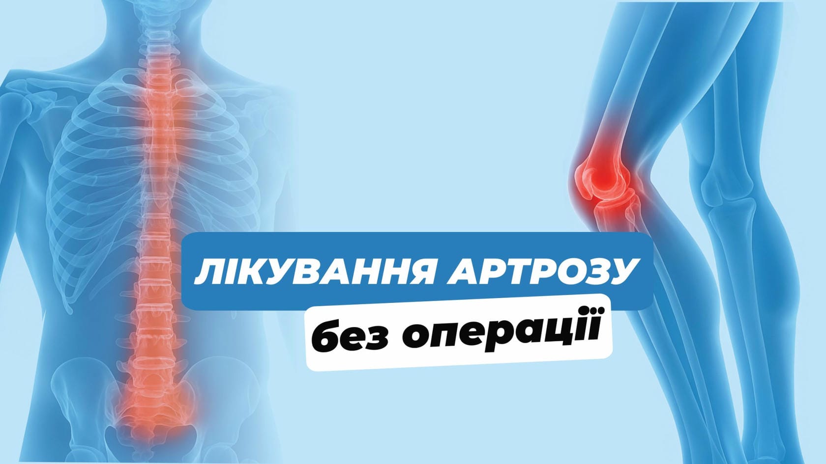 Лікування артрозу без операції