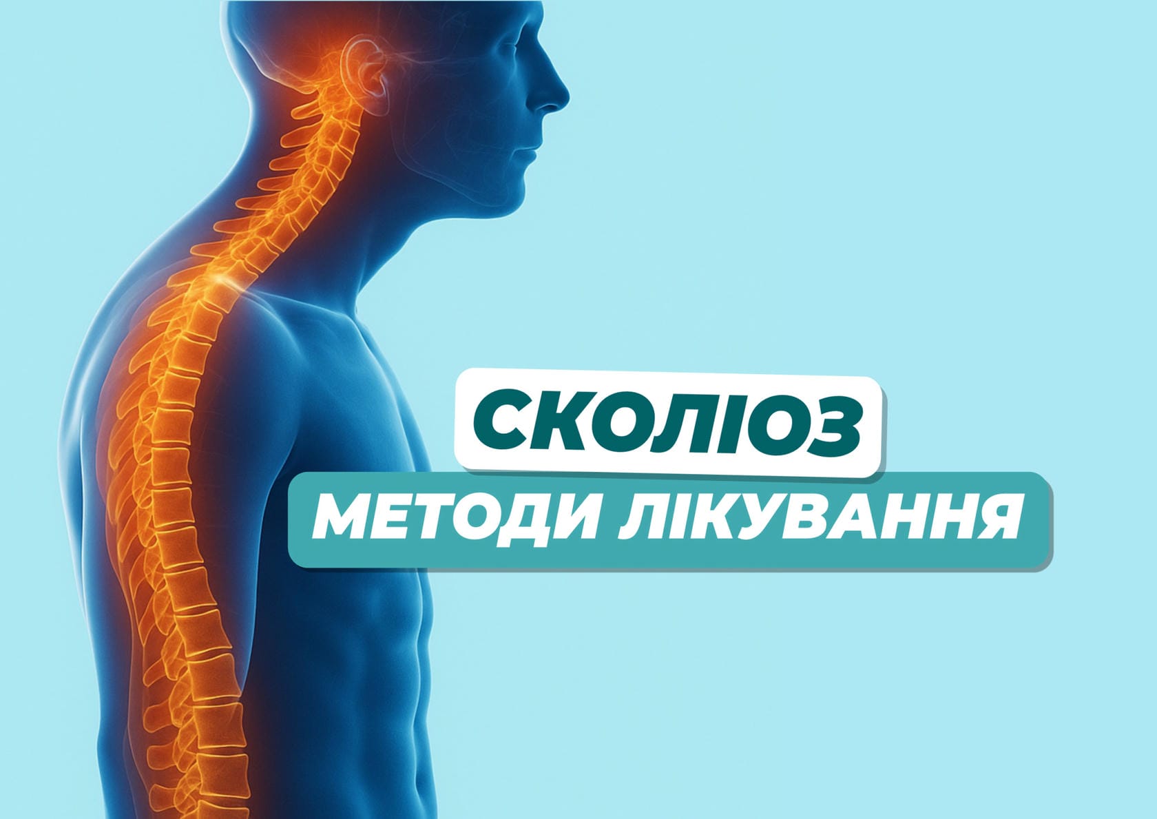 Сколіоз у дітей і дорослих