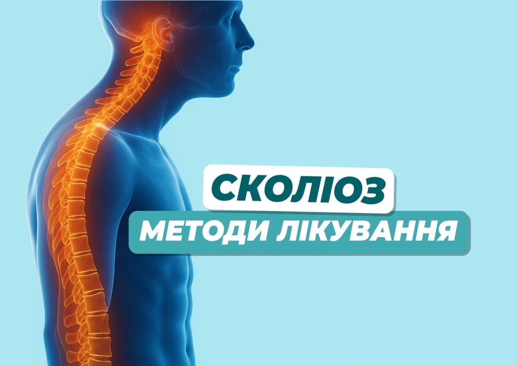 skolioz