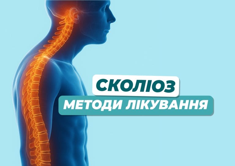 skolioz