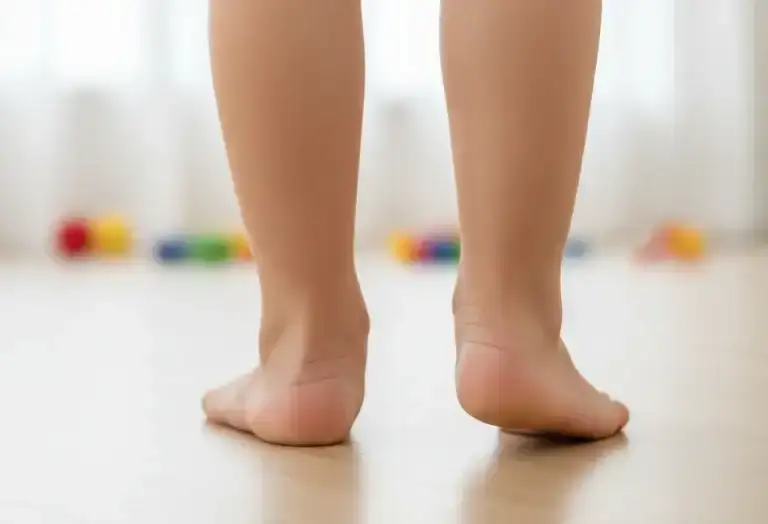 plosko valgusna deformacziya u ditej 1