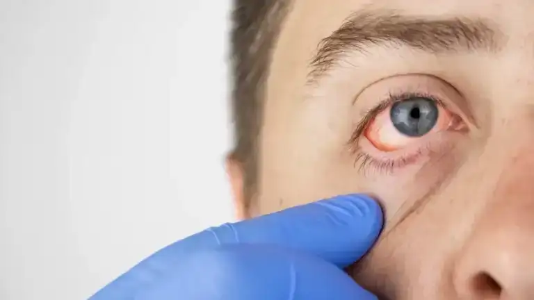 syndrom rejtera 1200x675.png