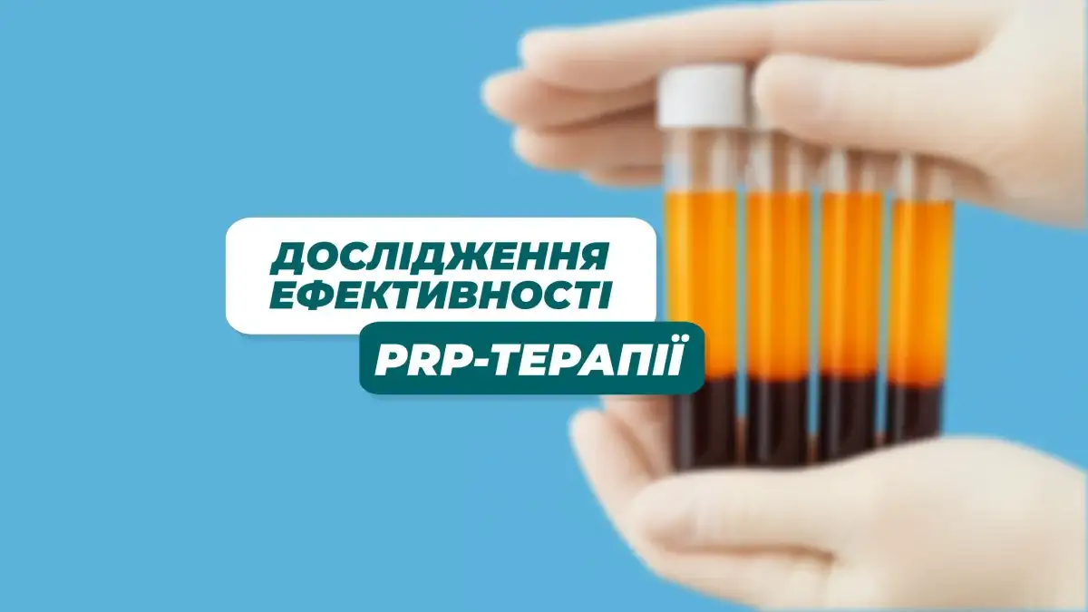 Аналіз досліджень ефективності PRP-терапії